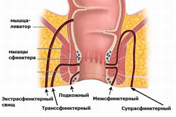 Ослабляется Ли Сфинктер После Одного Анального Секса