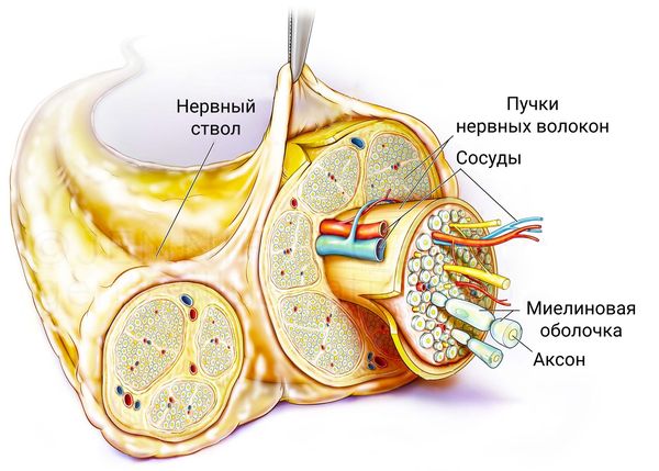 Нейропатия