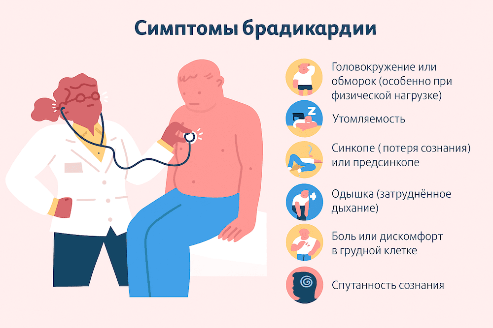 Брадикардия симптомы