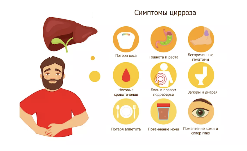 Симптомы цирроза