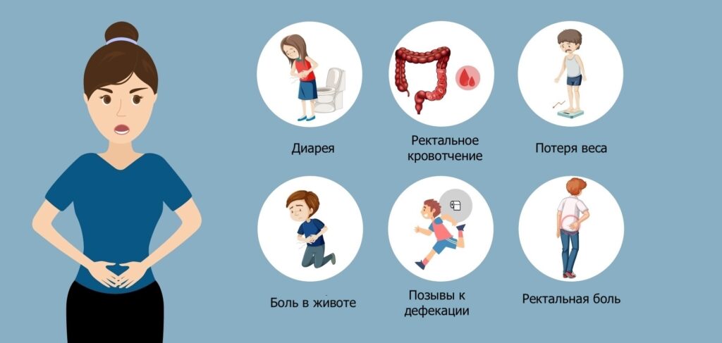 Симптомы язвенного колита