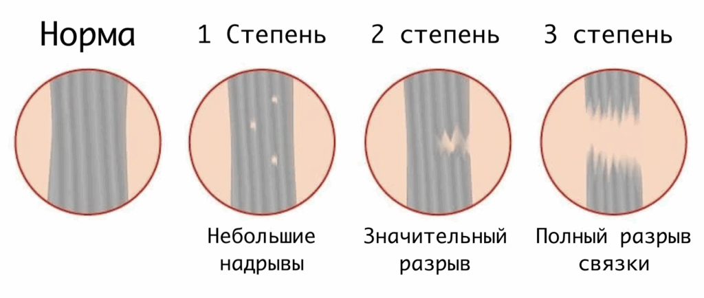 Степени растяжения