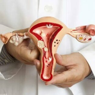 Эндометриоз: как я помогаю пациенткам с Юга России там, где не справились региональные клиники